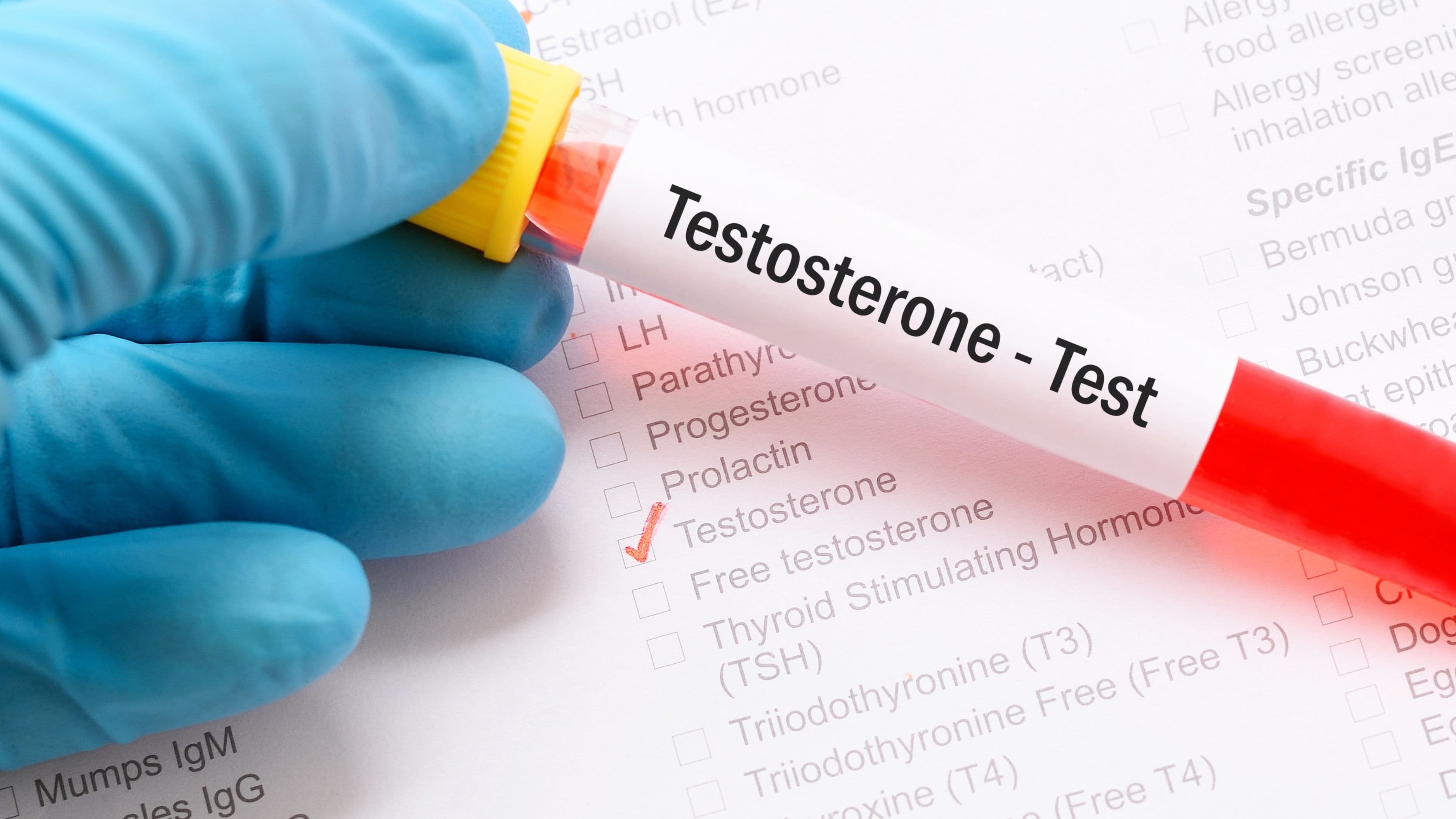 Does Boron Supplementation Move Testosterone Markers?