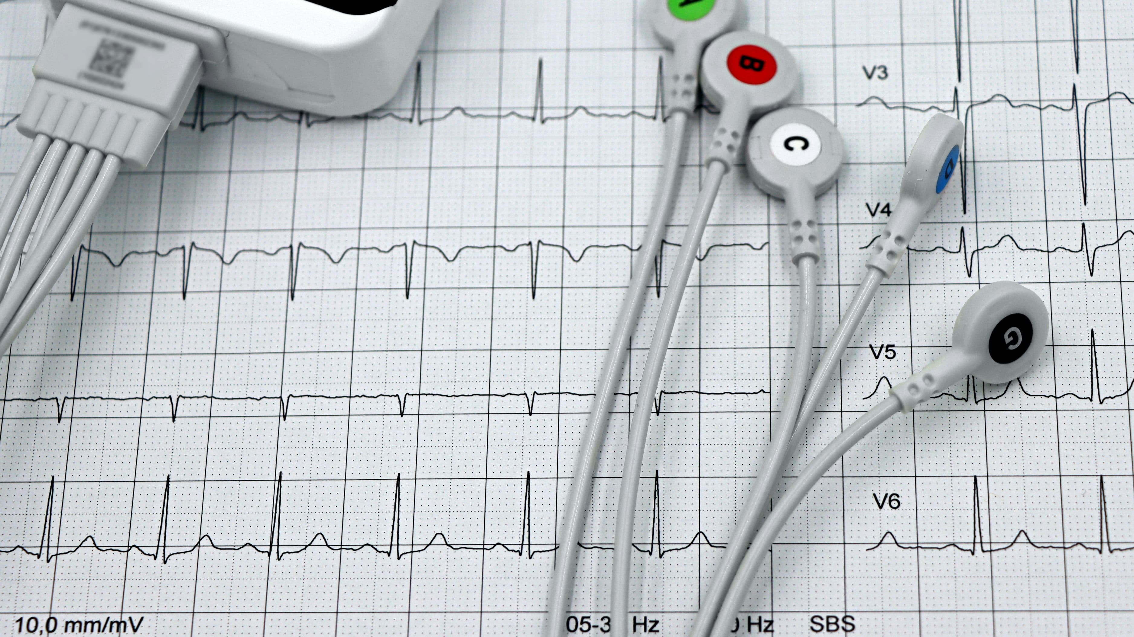 Why Your Hrv Score Is the Most Honest Metric You Have
